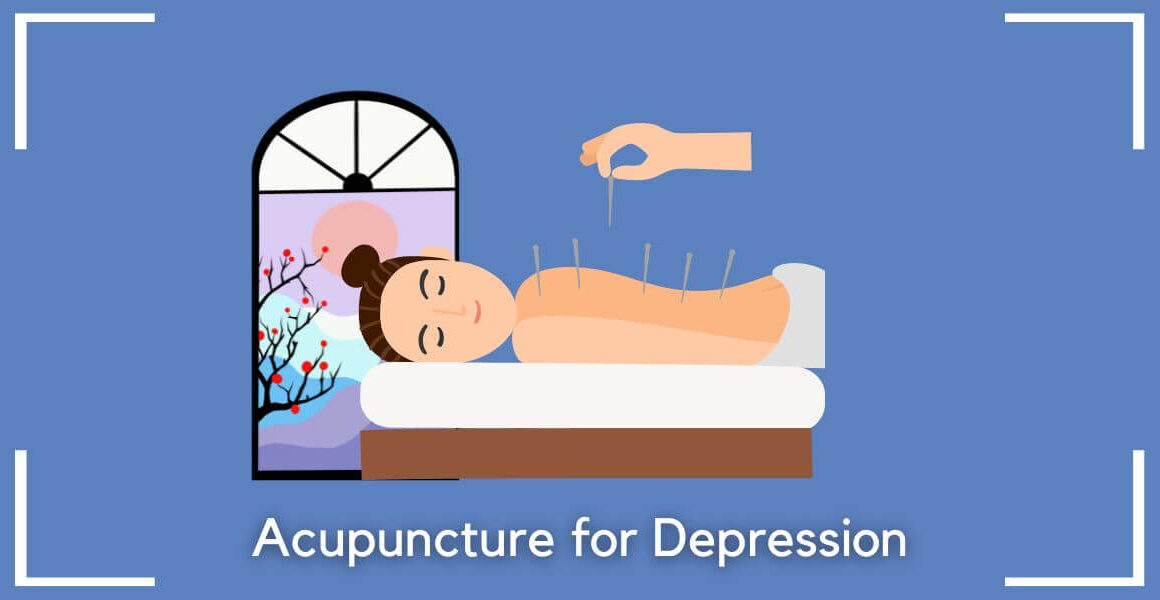 acupuncture for depression